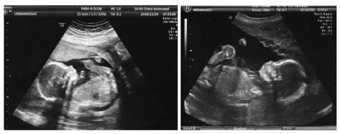 kiri: kakakkanan: adik